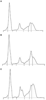 Preliminary assessment of serum capillary zone electrophoresis in the Asian elephant (Elephas maximus)